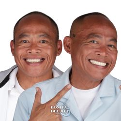 Bonita Del Rey Dental Care - Full Arch Permanent Smile!