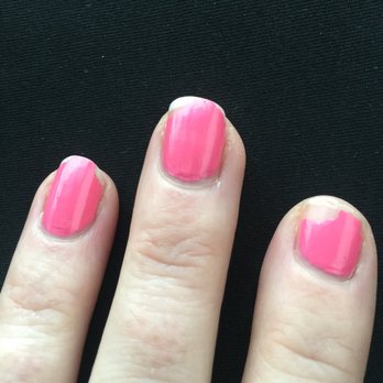 Indulge- The Spa At Caesars - Three days after manicure. - Day Spas Near Me - Elizabeth, Indiana Indulge- The Spa At Caesars - Three days after manicure. - Day Spas Near Me - Elizabeth, Indiana