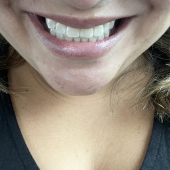Jergensen Dentistry and Orthodontics - Cleaning all done. - Oral Surgeons Near Me - Fairfield, California