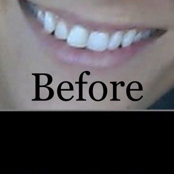 Sunshine Dental: Hung Chau, DDS - General Dentistry Near Me - Houston, Texas Sunshine Dental: Hung Chau, DDS - General Dentistry Near Me - Houston, Texas