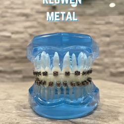 GO Orthodontics - Modality: KLOwen Self-Ligating Metal Braces