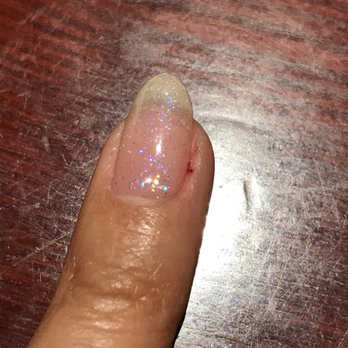 Phoenix Nails & Spa - Here's my ring finger that actually bled. - Nail Salons Near Me - Los Alamitos, California