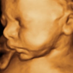 My First Peekaboo Ultrasound - One of our 3D Ultrasound pics