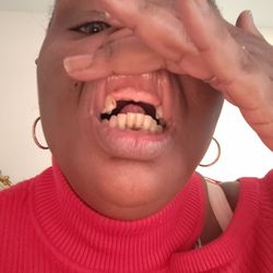 Magic Dentists - This doctor took all my teeth out while I was under Anastasia they are fraudulent and they will lie and steal your money and teeth