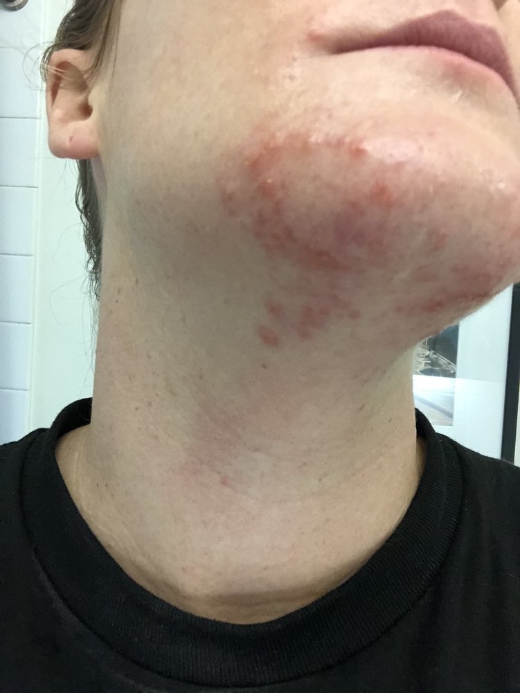 PREFERRED IMAGE ELECTROLYSIS NYC 13 Photos & 31 Reviews 10 E 39th