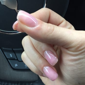Jolie Petite - Look at the discoloration! - Nail Salons Near Me - Alexandria, Virginia