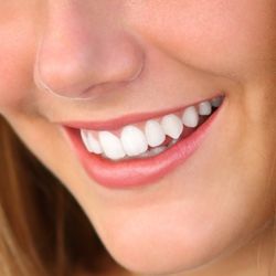 Gulch Cosmetic Dentistry - Teeth whitening