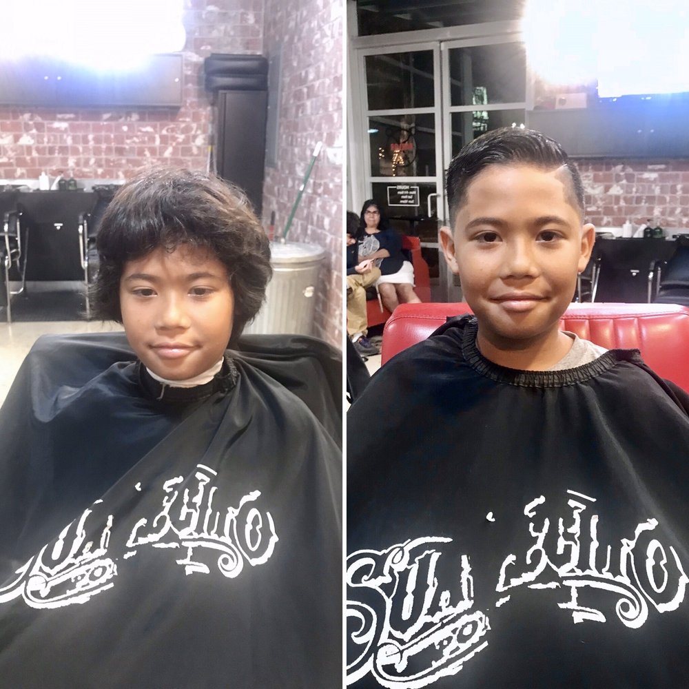 Left-Before Right-After Left-Before Right-After