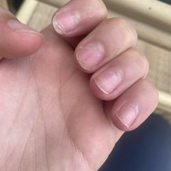 Ongles Lotus