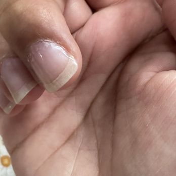 Q Nail Salon - $115 for gel on toes and clear gel on nails. That's pealing and flaking 7 days later. I'd clarify price before service. - Nail Salons Near Me - Petoskey, Michigan Q Nail Salon - $115 for gel on toes and clear gel on nails. That's pealing and flaking 7 days later. I'd clarify price before service. - Nail Salons Near Me - Petoskey, Michigan