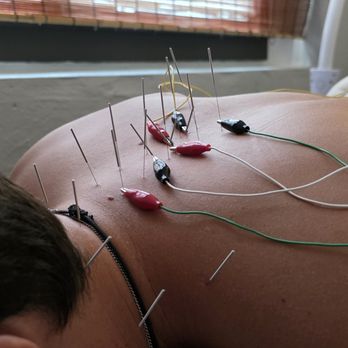 Hoots Acupuncture - Hoots Acupuncture in Williamsburg for Neck Pain Relief - Acupuncture Near Me - Brooklyn, New York Hoots Acupuncture - Hoots Acupuncture in Williamsburg for Neck Pain Relief - Acupuncture Near Me - Brooklyn, New York