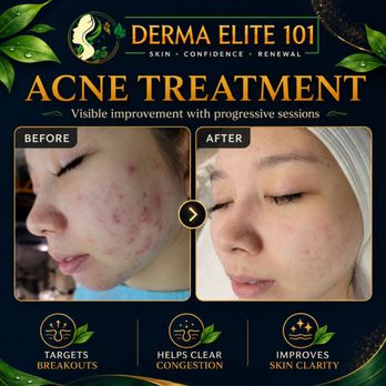 Derma Elite 101 - Skin Care Near Me - Las Vegas, Nevada