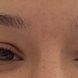 Before Before