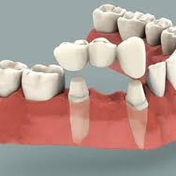 ABQ Gentle Dentistry - Periodontics Albuquerque, NM