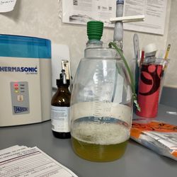 WHASN Meadows - Fluids drained from my lungs