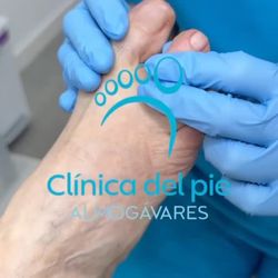 Clínica del Pie Almogávares - No es magia.
Es silicona... bien usada."

Si tienes roces, durezas o dolor al caminar,
no tienes que aguantarlo "porque sí".