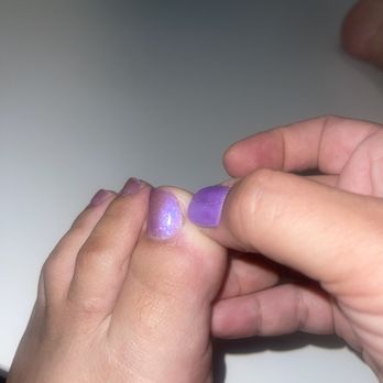 Hands Down - The angled cut on my big toenail that the technician made without asking me first. - Nail Salons Near Me - Claremont, California Hands Down - The angled cut on my big toenail that the technician made without asking me first. - Nail Salons Near Me - Claremont, California