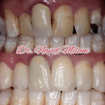Milani Dentistry - Cosmetic Dentists Near Me - Vaughan, Ontario