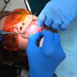 We Care Dental - After cleaning & polishing.