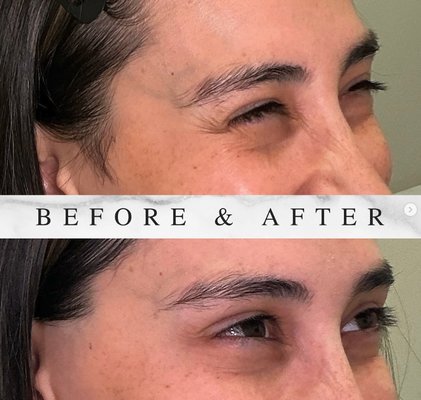 Ultherapy® - Botox - Fillers - Hydrafacial™- Microblading. - Botox  - Filler - Kybella - Hydrafacial - GENEO - SkinPen - Ultherapy - Medical weight loss - Lashes Extensions - Microblading - IV Therapy - Dermaplaning