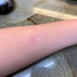 Dermatology Associates - How dr sheks scars look