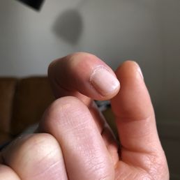 Streaky nail Streaky nail