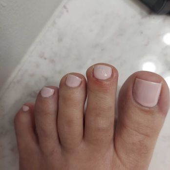 Allure Nail Spa - Sore toe where the Dremel sanded away my skin because the guy was too lazy to actually clip away skin, he just sanded it! - Waxing Near Me - Dalton, Georgia Allure Nail Spa - Sore toe where the Dremel sanded away my skin because the guy was too lazy to actually clip away skin, he just sanded it! - Waxing Near Me - Dalton, Georgia