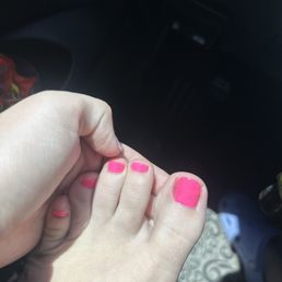 Rounded toenail