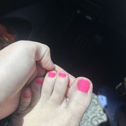 Rounded toenail