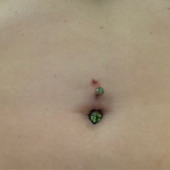 Decorative Injections - That is my navel - Tattoo Near Me - Athens, Ohio