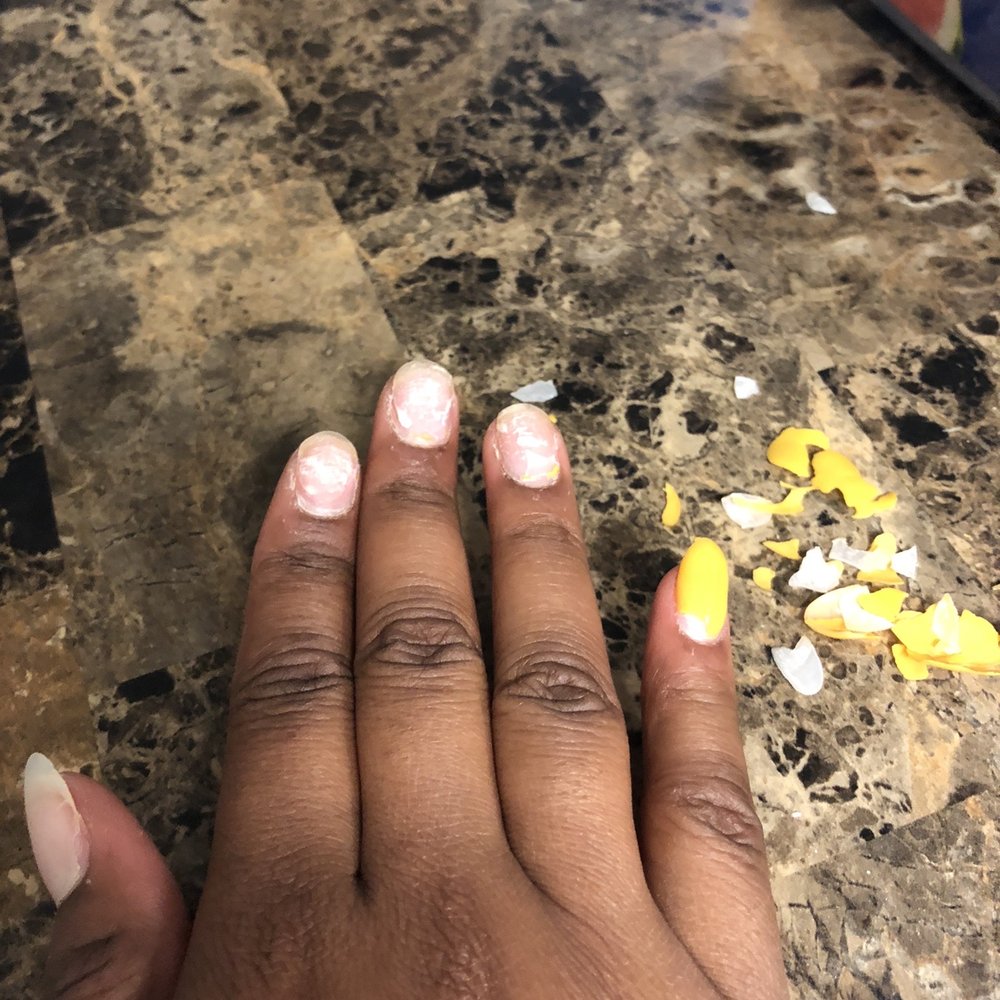 Creative Nails - Nails AND polish peeled off! - Nail Salons Near Me - Las Vegas, Nevada Creative Nails - Nails AND polish peeled off! - Nail Salons Near Me - Las Vegas, Nevada