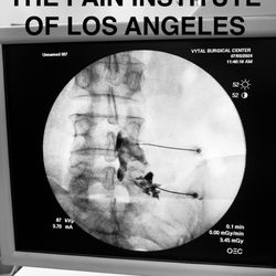 Sherwin Barvarz, MD - The Pain Institute