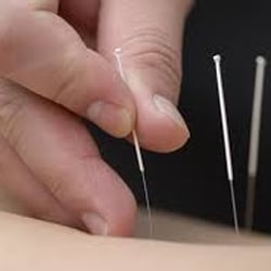 Blue Heron Acupuncture - BLUE HERON ACUPUNCTURE