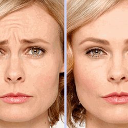 Bare Med Spa - Skin Rejuvenation