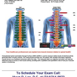 Myovision sEMG Computerized Spinal Screening