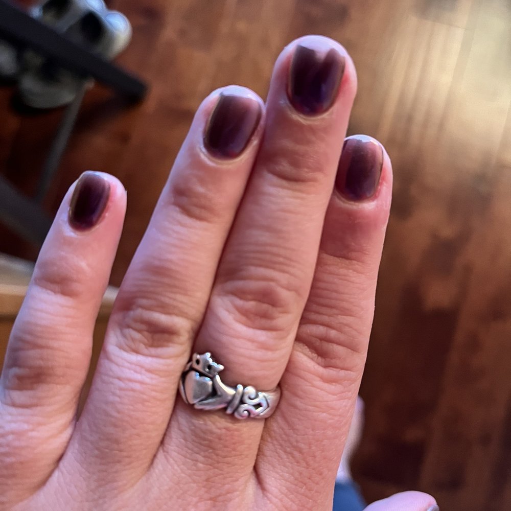 Chipped nails. Chipped nails.