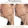 Photo of Westhetics