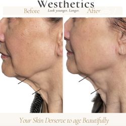 Westhetics