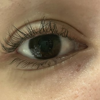 Amazing Lash Studio - This is after a few days. The results are awful on one eye. - Eyelash Service Near Me - Peoria, Arizona