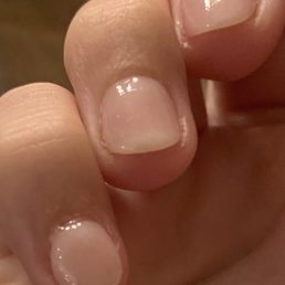 SNS - thick, covering cuticles, rough