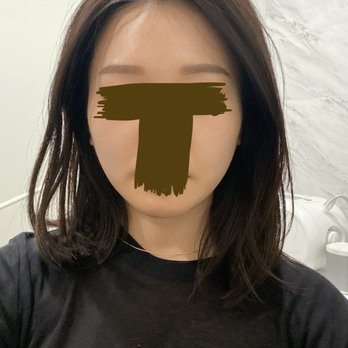 Spa De La Peau - skin tightening, face lift, after photo - Medical Spas Near Me - Los Angeles, California Spa De La Peau - skin tightening, face lift, after photo - Medical Spas Near Me - Los Angeles, California