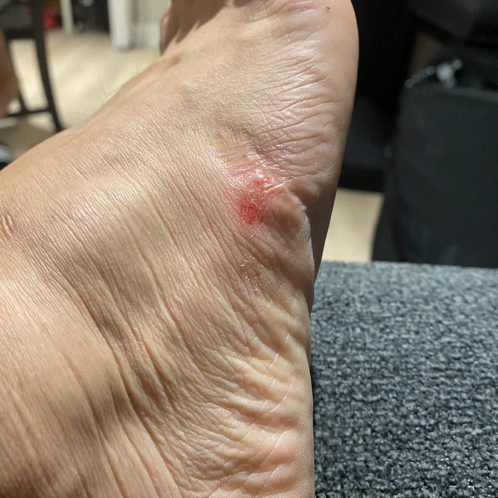 The lady who did my pedicure was so ruff scraping the sides and she scraped my skin on both sides. That hurt The lady who did my pedicure was so ruff scraping the sides and she scraped my skin on both sides. That hurt