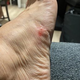 The lady who did my pedicure was so ruff scraping the sides and she scraped my skin on both sides. That hurt The lady who did my pedicure was so ruff scraping the sides and she scraped my skin on both sides. That hurt