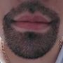Photo of Betanzos Injerto Capilar & Skin