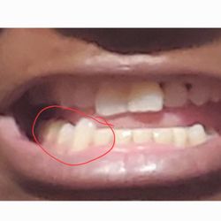 A Harvey Leslie, DMD - Cleveland Dental Clinic - Heard this place was A-1. Don't believe everything you hear!!!!!!! Over $1000 wasted