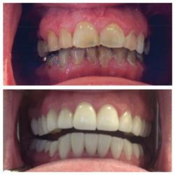 Gentle Family Dentistry - Gentle Family Dentistry | Loves Park, IL