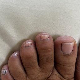 This is the pedicure I got there this morning. So disappointed I couldn't see this when I was there. Waste of my money! This is the pedicure I got there this morning. So disappointed I couldn't see this when I was there. Waste of my money!