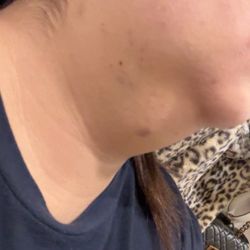 The House Call Beauty - Kybella