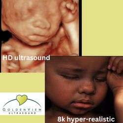 GoldenView Ultrasound - HD to 8K ultrasound edits offered at Goldenview Ultrasound San Antonio.