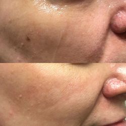 Great Skin Rules